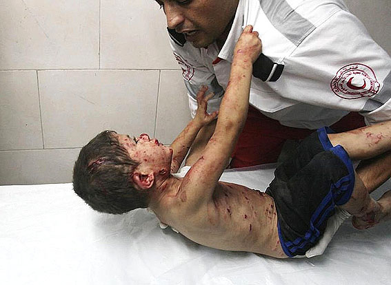 Criança ferida por bombas israelenses, em desespero, se agarra a socorrista